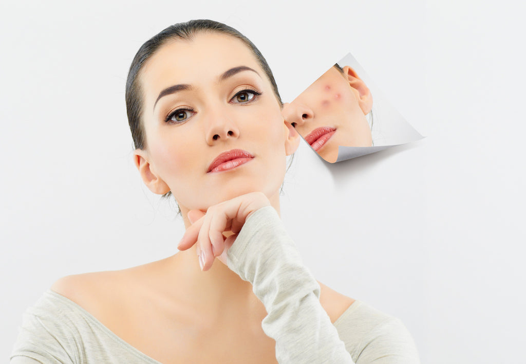 How to Deal With Purging From Chemical Peels – Oxygenetix