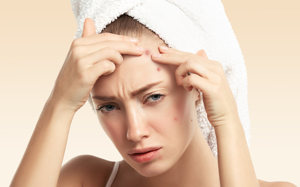 are-your-haircare-products-causing-acne-breakouts-oxygenetix